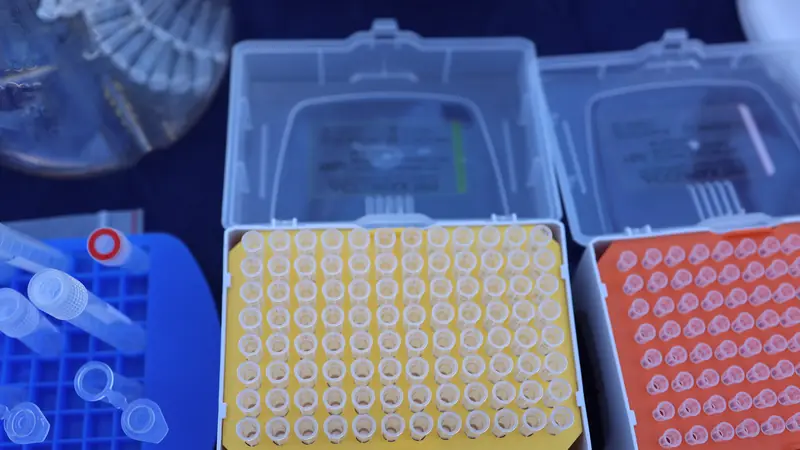 Boxes of disposable pipette tips on a laboratory bench